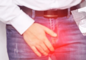 Varicocèle Testiculaire: définition causes et traitements