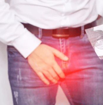 Varicocèle : Symptômes causes diagnostic et traitement sûr
